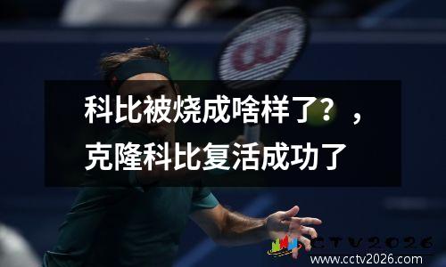 科比被烧成啥样了？，克隆科比复活成功了