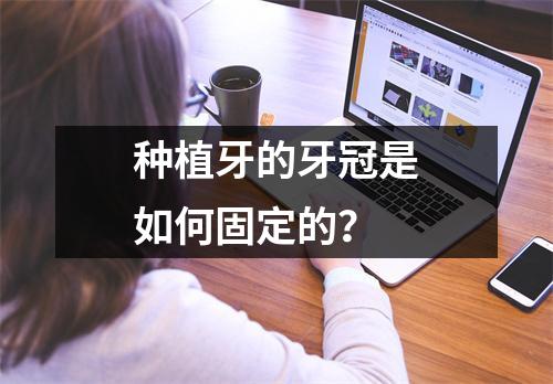 种植牙的牙冠是如何固定的？