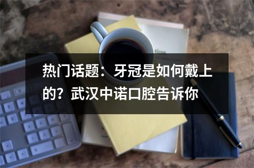 热门话题：牙冠是如何戴上的？武汉中诺口腔告诉你