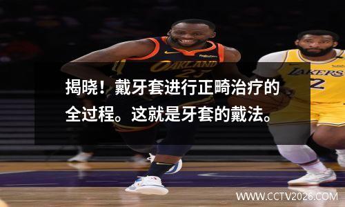 揭晓！戴牙套进行正畸治疗的全过程。这就是牙套的戴法。