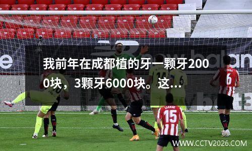 我前年在成都植的牙一颗牙2000块，3颗牙6000块。这不是吹牛。